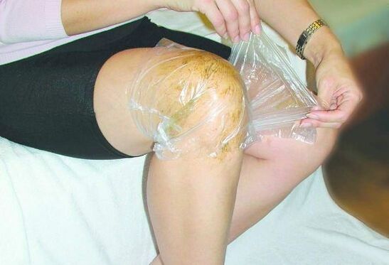Kompresse am Knie bei Arthrose