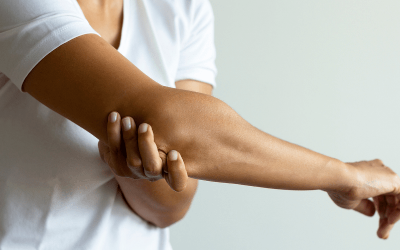 Offensichtliche Symptome einer Arthrose der Hände.